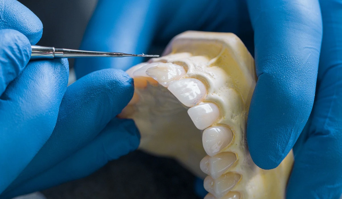 laboratoire-protheses paris